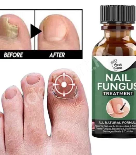 fast-nail-fungal-treatments-nail-repair-essences-serum-care-treatments-foot-nail-fungus-removal-gel-paronychia-product-image