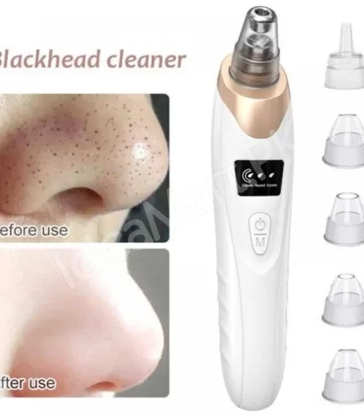 5-in-1-blackhead-remover-machine-pore-vacuum-electric-facial-pore-cleaner-acne-whitehead-blackhead-vacuum-machine-dust-remover-dirt-remover-pimple-extractor-usb-rechargeable-blackhead-removal-ma-product-image