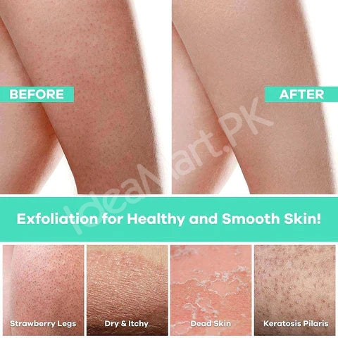 exfoliating-scrub-mitt-glove-for-deep-skin-cleansing-dead-skin-removal-and-body-spa-massage-product-image